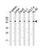 Interleukin 2 Receptor Subunit Gamma antibody, MBS9214003, MyBioSource, Western Blot image 