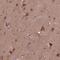 ST6 N-Acetylgalactosaminide Alpha-2,6-Sialyltransferase 5 antibody, PA5-64442, Invitrogen Antibodies, Immunohistochemistry paraffin image 