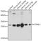 CD99 Molecule Like 2 antibody, A09721, Boster Biological Technology, Western Blot image 