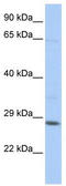 TGFB Induced Factor Homeobox 2 Like X-Linked antibody, TA341452, Origene, Western Blot image 