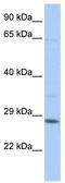 TGFB Induced Factor Homeobox 2 Like X-Linked antibody, TA341452, Origene, Western Blot image 