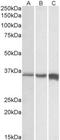 Troponin T3, Fast Skeletal Type antibody, NBP2-26199, Novus Biologicals, Western Blot image 