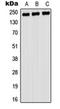 Myosin Heavy Chain 9 antibody, orb215495, Biorbyt, Western Blot image 