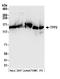 Tripeptidyl Peptidase 2 antibody, A304-757A, Bethyl Labs, Western Blot image 