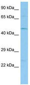 Tektin 1 antibody, TA346524, Origene, Western Blot image 