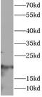 CD3 antibody, FNab10016, FineTest, Western Blot image 