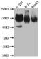 Integrin Subunit Alpha V antibody, CSB-RA279866A0HU, Cusabio, Western Blot image 