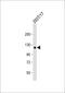 Collagen Type II Alpha 1 Chain antibody, 57-548, ProSci, Western Blot image 