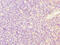 Sideroflexin 4 antibody, CSB-PA744046LA01HU, Cusabio, Immunohistochemistry paraffin image 