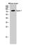 Epsin 1 antibody, A01870, Boster Biological Technology, Western Blot image 