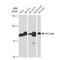 Protein Kinase C Delta antibody, GTX02829, GeneTex, Western Blot image 