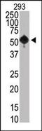 Lysine Methyltransferase 5A antibody, MA5-11141, Invitrogen Antibodies, Western Blot image 