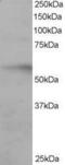 Interferon Regulatory Factor 6 antibody, GTX10925, GeneTex, Western Blot image 