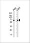 Far Upstream Element Binding Protein 3 antibody, M08695, Boster Biological Technology, Western Blot image 