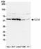 Chaperonin Containing TCP1 Subunit 4 antibody, NBP2-41360, Novus Biologicals, Immunoprecipitation image 