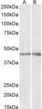 NPHS2 Stomatin Family Member, Podocin antibody, TA348987, Origene, Western Blot image 