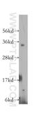 Proteasome 26S Subunit, Non-ATPase 14 antibody, 12059-1-AP, Proteintech Group, Western Blot image 