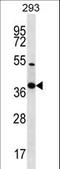 NK2 Homeobox 2 antibody, LS-C164896, Lifespan Biosciences, Western Blot image 