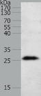 Nerve Growth Factor antibody, TA321493, Origene, Western Blot image 