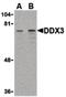 DEAD-Box Helicase 3 X-Linked antibody, LS-B2615, Lifespan Biosciences, Western Blot image 