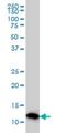 Profilin 2 antibody, H00005217-M04, Novus Biologicals, Western Blot image 