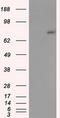 hsBG antibody, M11034, Boster Biological Technology, Western Blot image 