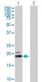 Interferon Omega 1 antibody, H00003467-B01P, Novus Biologicals, Western Blot image 