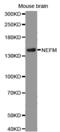 Neurofilament Medium antibody, MBS129145, MyBioSource, Western Blot image 
