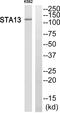 StAR Related Lipid Transfer Domain Containing 13 antibody, PA5-38834, Invitrogen Antibodies, Western Blot image 