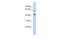 NAD Kinase 2, Mitochondrial antibody, A09619, Boster Biological Technology, Western Blot image 