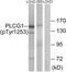 Phospholipase C Gamma 1 antibody, PA5-38318, Invitrogen Antibodies, Western Blot image 