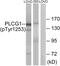 1-phosphatidylinositol-4,5-bisphosphate phosphodiesterase gamma-1 antibody, PA5-38318, Invitrogen Antibodies, Western Blot image 