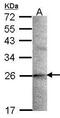 Stathmin 2 antibody, TA308308, Origene, Western Blot image 