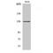 5-azacytidine-induced protein 1 antibody, LS-B15564, Lifespan Biosciences, Western Blot image 