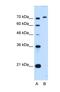 Glycosylphosphatidylinositol Anchor Attachment 1 antibody, NBP1-62435, Novus Biologicals, Western Blot image 