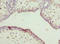 Interleukin 22 Receptor Subunit Alpha 2 antibody, LS-C675893, Lifespan Biosciences, Immunohistochemistry paraffin image 