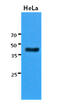 Keratin 23 antibody, MBS200254, MyBioSource, Western Blot image 