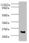 Serine And Arginine Rich Splicing Factor 9 antibody, orb241892, Biorbyt, Western Blot image 