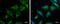 Rho Associated Coiled-Coil Containing Protein Kinase 2 antibody, GTX122651, GeneTex, Immunofluorescence image 