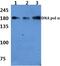 DNA Polymerase Alpha 1, Catalytic Subunit antibody, PA5-36147, Invitrogen Antibodies, Western Blot image 