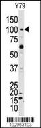 NIMA Related Kinase 4 antibody, 63-382, ProSci, Western Blot image 