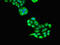 Unc-51 Like Autophagy Activating Kinase 1 antibody, LS-C682272, Lifespan Biosciences, Immunofluorescence image 
