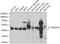 ADP Ribosylation Factor GTPase Activating Protein 1 antibody, GTX55515, GeneTex, Western Blot image 