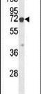 Keratin 9 antibody, PA5-24783, Invitrogen Antibodies, Western Blot image 