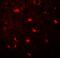 Microtubule Associated Protein 1 Light Chain 3 Gamma antibody, A08533, Boster Biological Technology, Immunofluorescence image 