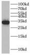 Solute Carrier Family 25 Member 34 antibody, FNab07941, FineTest, Western Blot image 