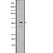 SUFU Negative Regulator Of Hedgehog Signaling antibody, GTX03498, GeneTex, Western Blot image 