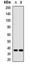 G Protein Subunit Beta 1 antibody, LS-C668853, Lifespan Biosciences, Western Blot image 