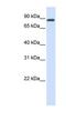 HECT Domain E3 Ubiquitin Protein Ligase 2 antibody, NBP1-55081, Novus Biologicals, Western Blot image 