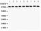 Catenin Alpha 1 antibody, LS-C343999, Lifespan Biosciences, Western Blot image 